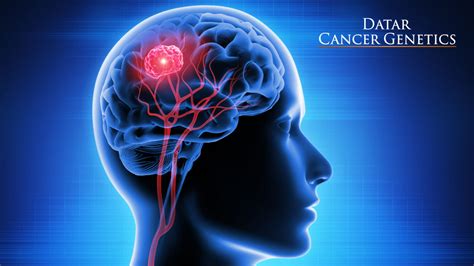 grants for brain tumors
